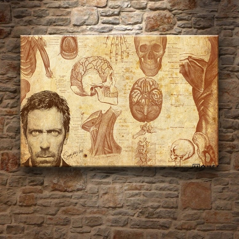 HOUSE-IT ISNT LUPUS 7 değişen ölçü ORİJİNAL KANVAS TABLO