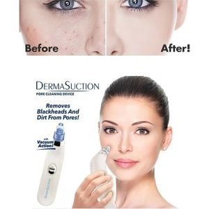 Derma Suction Vakum Yüz Akne Temizleyici Siyah Nokta Temizleme Pratik Cihaz