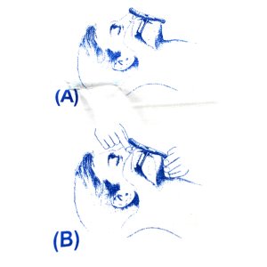 Cepte Taşınan Anahtarlıklı Eldivenli Suni Teneffüs Ağız Maskesi Suni Solunum Ağızlığı