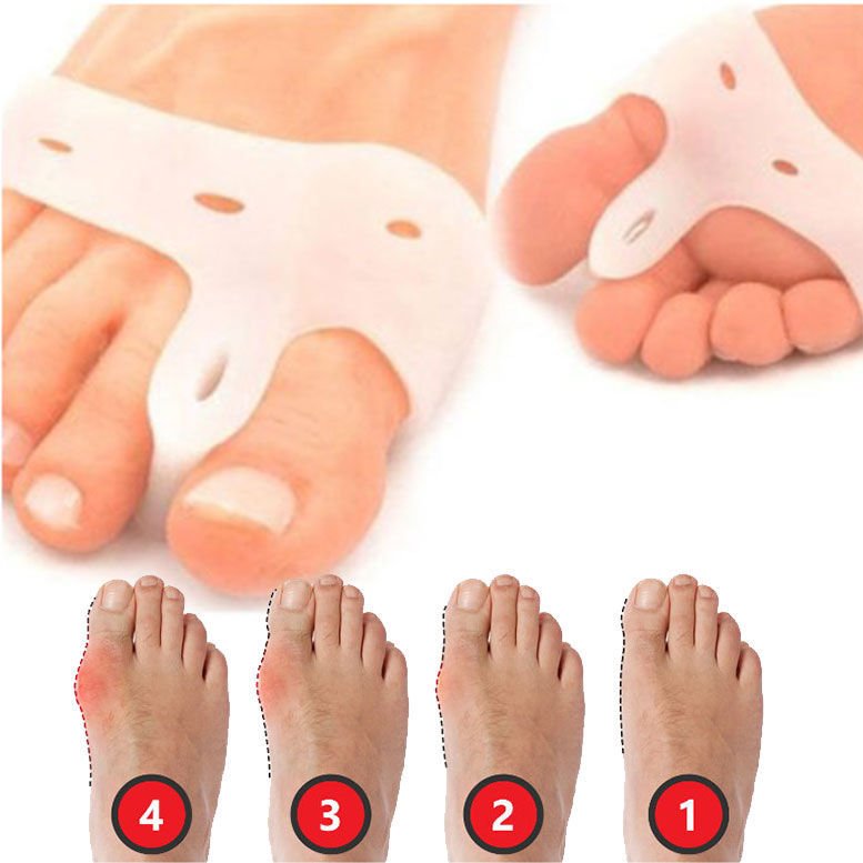 Halluks Valgus Silikon Yastık Korumalı Makaralı Başparmak Geçen Korucu Bunyon Ayak Gece Bunyonu