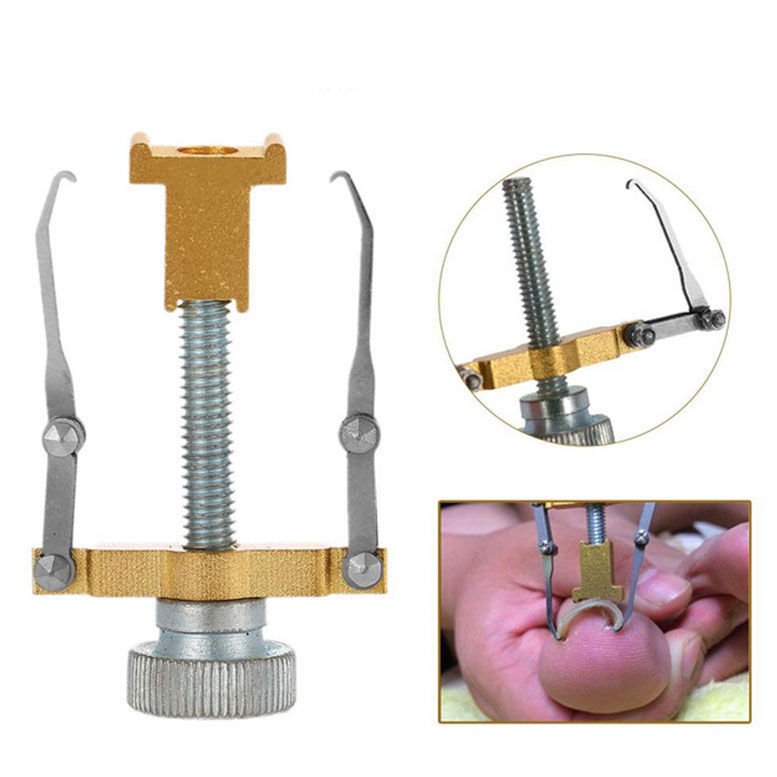 Batık Tırnak Düzeltme Batan Tırnağı Çıkarma Aleti Aparatı Tırnak Batığı Çıkarıcı Alet