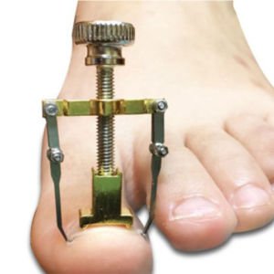 Batık Tırnak Düzeltme Batan Tırnağı Çıkarma Aleti Aparatı Tırnak Batığı Çıkarıcı Alet